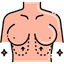 Breast Reshape